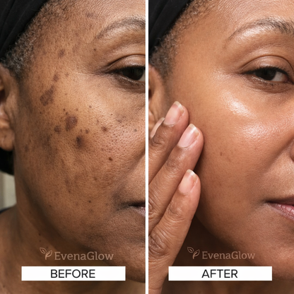 Anti-Dark Spots & Acne African Black Soap