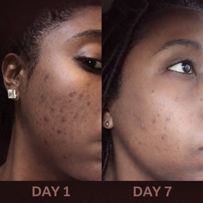 Nourished & Radiant Even Tone Serum