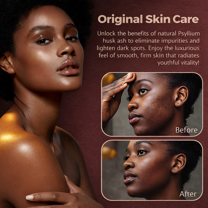 Anti-Dark Spots & Acne African Black Soap